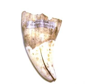 Tooth