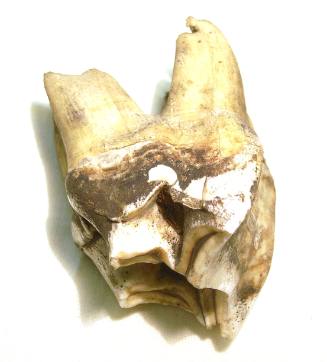 Tooth