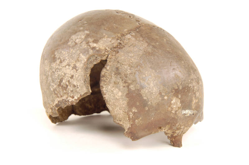Human-Remains
