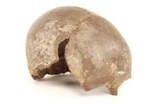 Human-Remains